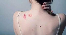 湿气重体质者 背上容易长痘痘 战痘首需驱除湿气、清虚火