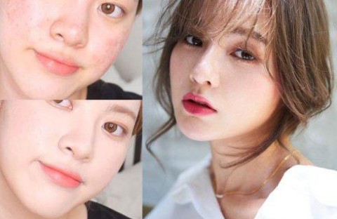 夏天疯狂冒痘 痘痘皮肤怎么化妆?痘痘、烂疮脸又薄又遮粉底技巧