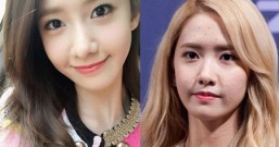 五个方法消除压力痘 轻松去除封闭性大痘痘