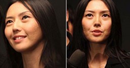 红色痘疤、深色痘疤怎么办?长痘后续保养就能淡化痘疤