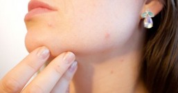 粉刺大爆发?夏天洗脸真确方法,选对时间跟水温对抗痘痘肌