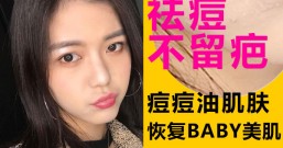 痘痘油肌也能轻松还原新生baby美肌,不留疤全攻略