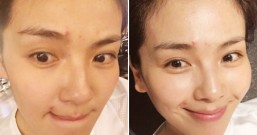 痘痘和你一定有特别的缘分,是因为你喜欢做这件事让痘痘跟你特别有缘