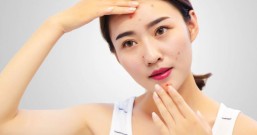 过了青春期照样狂冒痘好困扰!轻熟女都想问:医生我的脸怎么了?