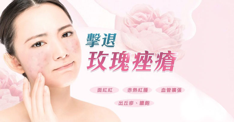 玫瑰痤疮